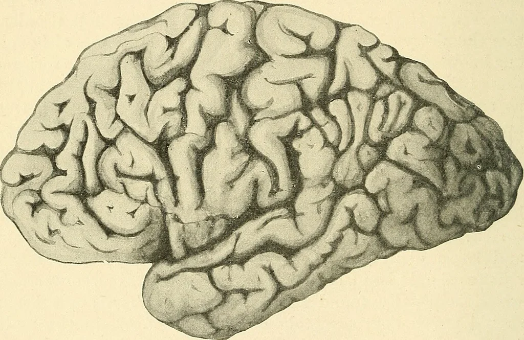 An illustration from Mental diseases : A text-book of psychiatry for medical students and practitioners / by R.H. Cole, ... With fifty-two illustrations and plates., 1913, leaf 260