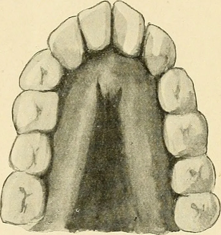 An illustration from Mental diseases : A text-book of psychiatry for medical students and practitioners / by R.H. Cole, ... With fifty-two illustrations and plates., 1913, leaf 283