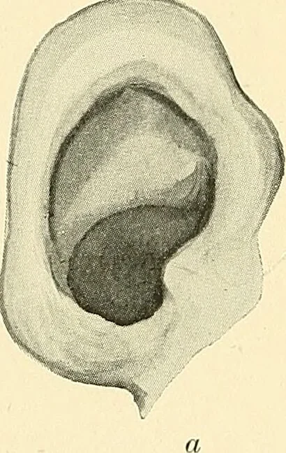 An illustration from Mental diseases : A text-book of psychiatry for medical students and practitioners / by R.H. Cole, ... With fifty-two illustrations and plates., 1913, leaf 284