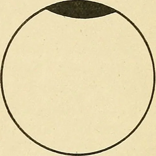 An illustration from Mental diseases : A text-book of psychiatry for medical students and practitioners / by R.H. Cole, ... With fifty-two illustrations and plates., 1913, leaf 33