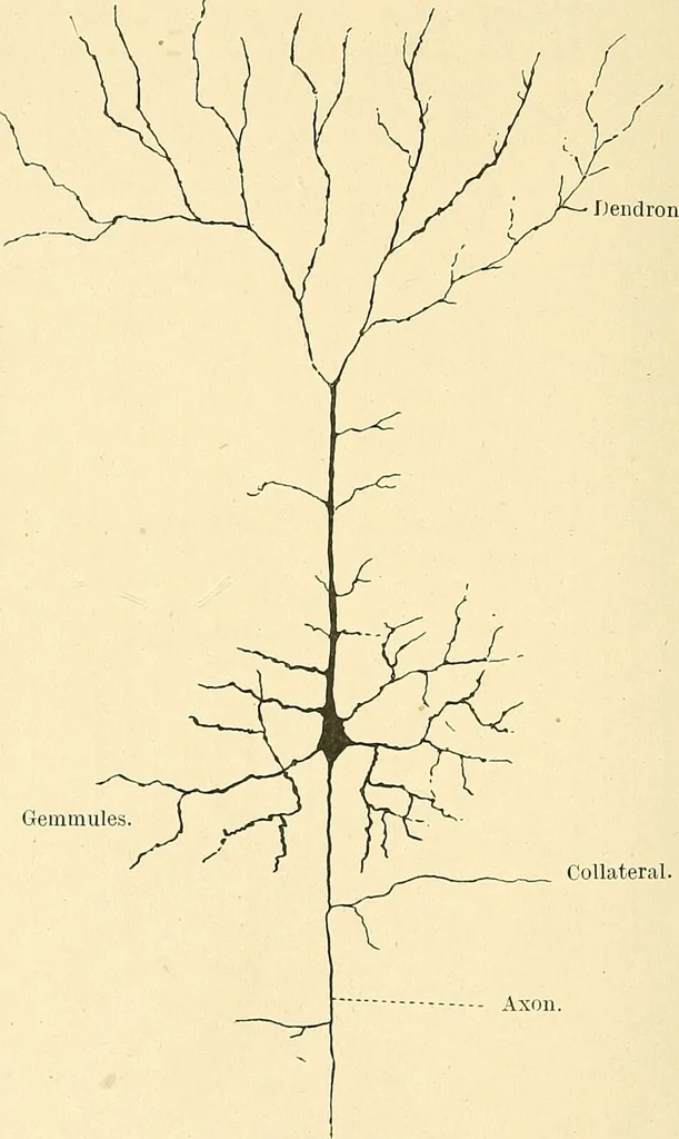 An illustration from Mental diseases : A text-book of psychiatry for medical students and practitioners / by R.H. Cole, ... With fifty-two illustrations and plates., 1913, leaf 40