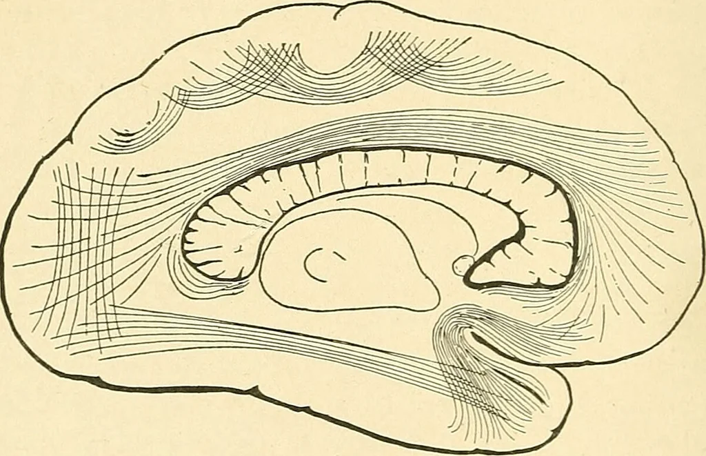 An illustration from Mental diseases : A text-book of psychiatry for medical students and practitioners / by R.H. Cole, ... With fifty-two illustrations and plates., 1913, leaf 48