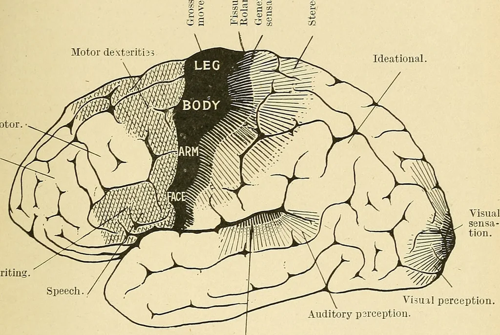 An illustration from Mental diseases : A text-book of psychiatry for medical students and practitioners / by R.H. Cole, ... With fifty-two illustrations and plates., 1913, leaf 49
