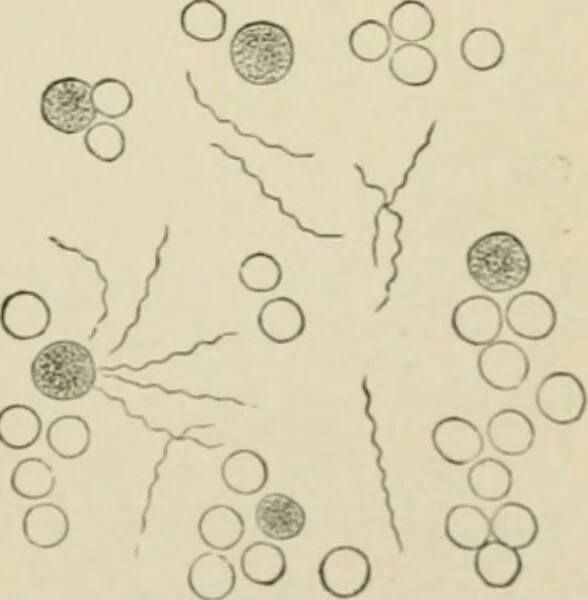 An illustration from Diseases of metabolism and of the blood : animal parasites, toxicology / ed. by Richard C. Cabot ... An authorized translation from "Die deutsche klinik" under the general editorial supervision of Julius L. Salinger, M. D. With one colored plate and fifty-eight illustrations in the text., 1906, leaf 311