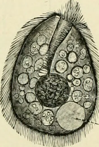 An illustration from Diseases of metabolism and of the blood : animal parasites, toxicology / ed. by Richard C. Cabot ... An authorized translation from "Die deutsche klinik" under the general editorial supervision of Julius L. Salinger, M. D. With one colored plate and fifty-eight illustrations in the text., 1906, leaf 532