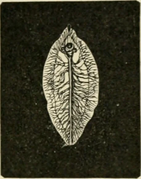 An illustration from Diseases of metabolism and of the blood : animal parasites, toxicology / ed. by Richard C. Cabot ... An authorized translation from "Die deutsche klinik" under the general editorial supervision of Julius L. Salinger, M. D. With one colored plate and fifty-eight illustrations in the text., 1906, leaf 533