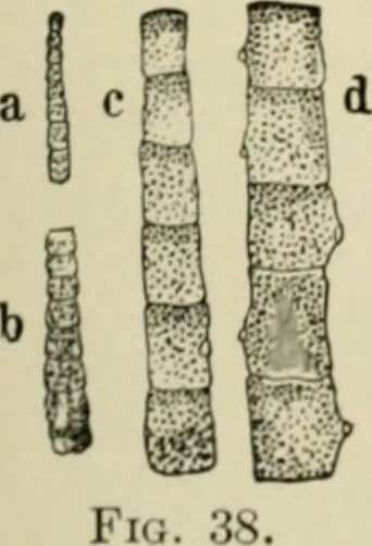 An illustration from Diseases of metabolism and of the blood : animal parasites, toxicology / ed. by Richard C. Cabot ... An authorized translation from "Die deutsche klinik" under the general editorial supervision of Julius L. Salinger, M. D. With one colored plate and fifty-eight illustrations in the text., 1906, leaf 541