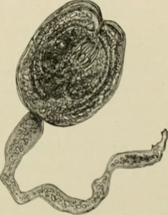 An illustration from Diseases of metabolism and of the blood : animal parasites, toxicology / ed. by Richard C. Cabot ... An authorized translation from "Die deutsche klinik" under the general editorial supervision of Julius L. Salinger, M. D. With one colored plate and fifty-eight illustrations in the text., 1906, leaf 543