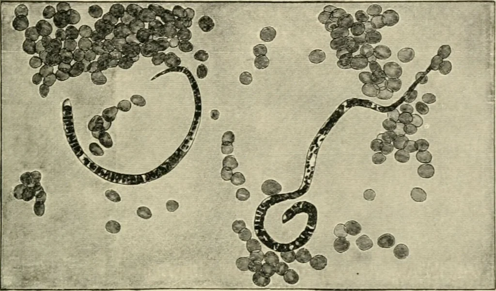 An illustration from Diseases of metabolism and of the blood : animal parasites, toxicology / ed. by Richard C. Cabot ... An authorized translation from "Die deutsche klinik" under the general editorial supervision of Julius L. Salinger, M. D. With one colored plate and fifty-eight illustrations in the text., 1906, leaf 571