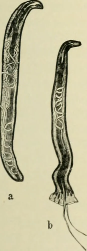 An illustration from Diseases of metabolism and of the blood : animal parasites, toxicology / ed. by Richard C. Cabot ... An authorized translation from "Die deutsche klinik" under the general editorial supervision of Julius L. Salinger, M. D. With one colored plate and fifty-eight illustrations in the text., 1906, leaf 585