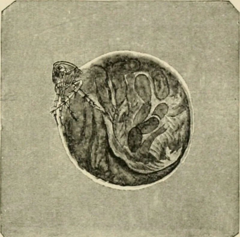 An illustration from Diseases of metabolism and of the blood : animal parasites, toxicology / ed. by Richard C. Cabot ... An authorized translation from "Die deutsche klinik" under the general editorial supervision of Julius L. Salinger, M. D. With one colored plate and fifty-eight illustrations in the text., 1906, leaf 597