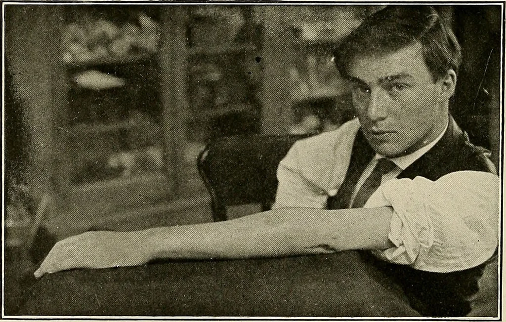 An illustration from Bismuth paste in chronic suppurations : its diagnostic importance and therapeutic value / by Emil G. Beck ... with an introduction by Carl Beck, M. D., and a chapter on the application of bismuth paste in the treatment of chronic suppuration of the nasal accessory sinuses and the ear, by Joseph C. Beck, M. D. With eighty-one engravings, nine diagrammatic illustrations, and a colored plate., 1914, leaf 168