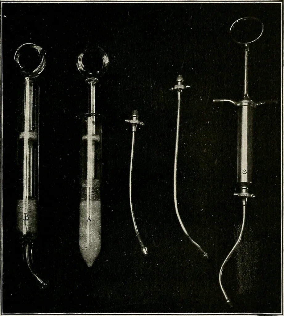 An illustration from Bismuth paste in chronic suppurations : its diagnostic importance and therapeutic value / by Emil G. Beck ... with an introduction by Carl Beck, M. D., and a chapter on the application of bismuth paste in the treatment of chronic suppuration of the nasal accessory sinuses and the ear, by Joseph C. Beck, M. D. With eighty-one engravings, nine diagrammatic illustrations, and a colored plate., 1914, leaf 33