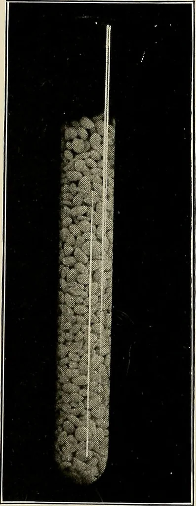 An illustration from Bismuth paste in chronic suppurations : its diagnostic importance and therapeutic value / by Emil G. Beck ... with an introduction by Carl Beck, M. D., and a chapter on the application of bismuth paste in the treatment of chronic suppuration of the nasal accessory sinuses and the ear, by Joseph C. Beck, M. D. With eighty-one engravings, nine diagrammatic illustrations, and a colored plate., 1914, leaf 88