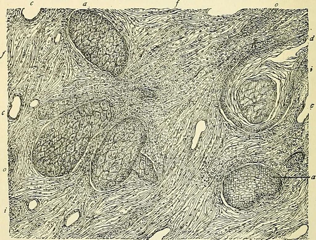 An illustration from An American text-book of genito-urinary diseases, syphilis and diseases of the skin / Ed. by L. Bolton Bangs ... and W. A. Hardaway ... Illustrated with 300 engravings and 20 full-page colored plates., 1898, leaf 1172