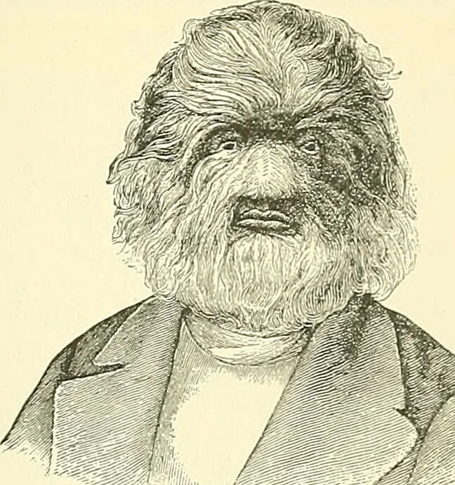 An illustration from An American text-book of genito-urinary diseases, syphilis and diseases of the skin / Ed. by L. Bolton Bangs ... and W. A. Hardaway ... Illustrated with 300 engravings and 20 full-page colored plates., 1898, leaf 1177