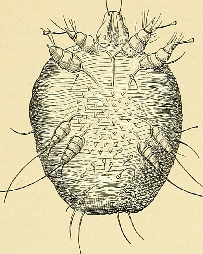 An illustration from An American text-book of genito-urinary diseases, syphilis and diseases of the skin / Ed. by L. Bolton Bangs ... and W. A. Hardaway ... Illustrated with 300 engravings and 20 full-page colored plates., 1898, leaf 1250