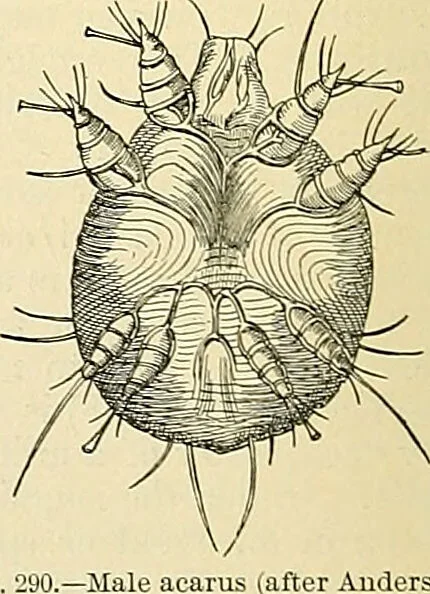 An illustration from An American text-book of genito-urinary diseases, syphilis and diseases of the skin / Ed. by L. Bolton Bangs ... and W. A. Hardaway ... Illustrated with 300 engravings and 20 full-page colored plates., 1898, leaf 1250
