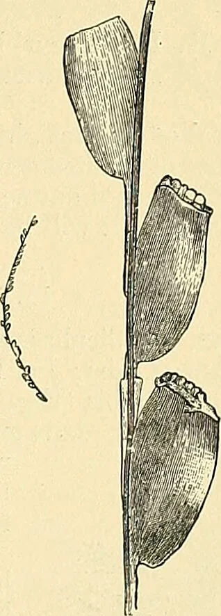 An illustration from An American text-book of genito-urinary diseases, syphilis and diseases of the skin / Ed. by L. Bolton Bangs ... and W. A. Hardaway ... Illustrated with 300 engravings and 20 full-page colored plates., 1898, leaf 1255