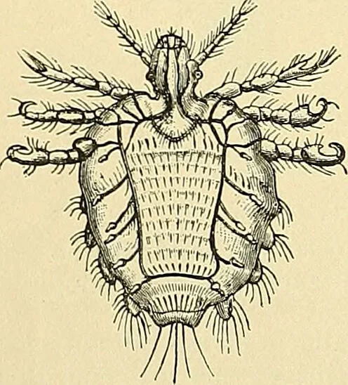 An illustration from An American text-book of genito-urinary diseases, syphilis and diseases of the skin / Ed. by L. Bolton Bangs ... and W. A. Hardaway ... Illustrated with 300 engravings and 20 full-page colored plates., 1898, leaf 1256