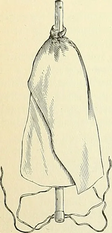 An illustration from An American text-book of genito-urinary diseases, syphilis and diseases of the skin / Ed. by L. Bolton Bangs ... and W. A. Hardaway ... Illustrated with 300 engravings and 20 full-page colored plates., 1898, leaf 210