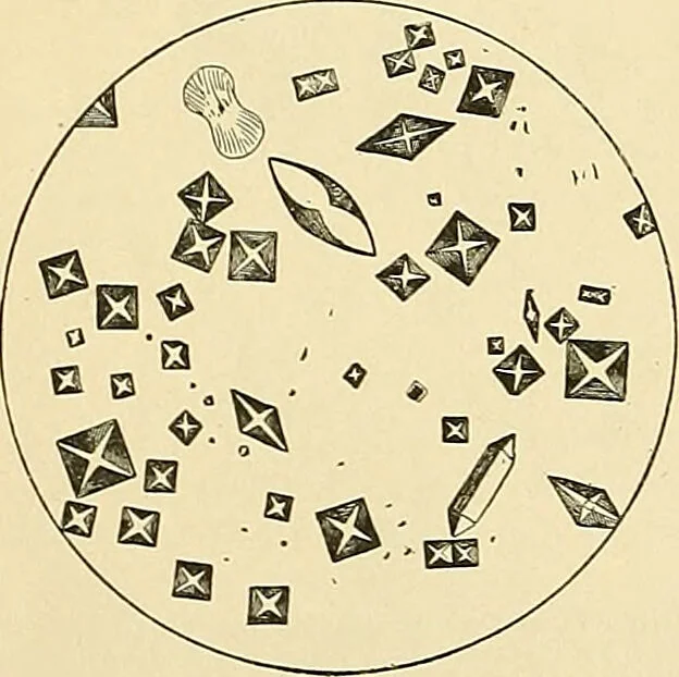 An illustration from An American text-book of genito-urinary diseases, syphilis and diseases of the skin / Ed. by L. Bolton Bangs ... and W. A. Hardaway ... Illustrated with 300 engravings and 20 full-page colored plates., 1898, leaf 30