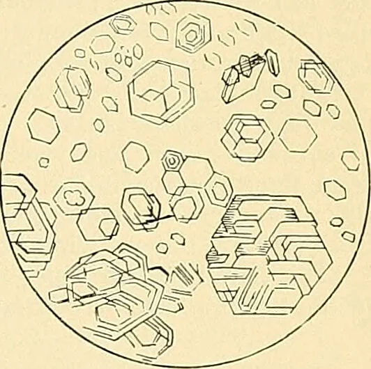 An illustration from An American text-book of genito-urinary diseases, syphilis and diseases of the skin / Ed. by L. Bolton Bangs ... and W. A. Hardaway ... Illustrated with 300 engravings and 20 full-page colored plates., 1898, leaf 31