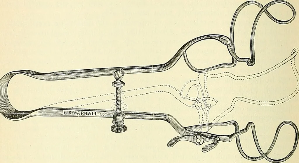 An illustration from An American text-book of genito-urinary diseases, syphilis and diseases of the skin / Ed. by L. Bolton Bangs ... and W. A. Hardaway ... Illustrated with 300 engravings and 20 full-page colored plates., 1898, leaf 316
