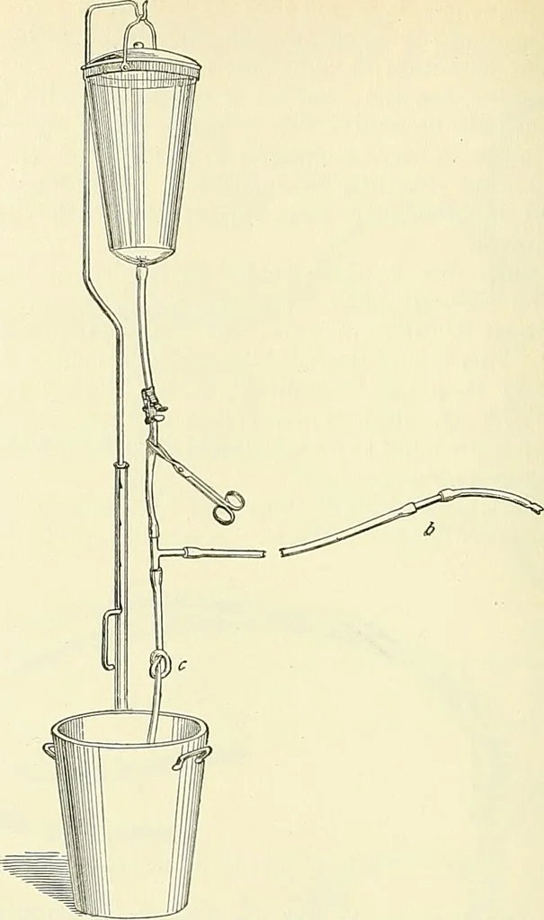An illustration from An American text-book of genito-urinary diseases, syphilis and diseases of the skin / Ed. by L. Bolton Bangs ... and W. A. Hardaway ... Illustrated with 300 engravings and 20 full-page colored plates., 1898, leaf 318