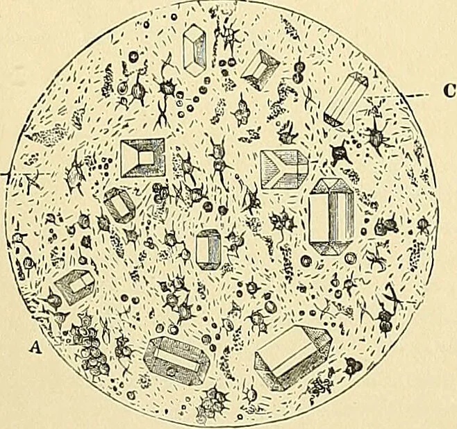 An illustration from An American text-book of genito-urinary diseases, syphilis and diseases of the skin / Ed. by L. Bolton Bangs ... and W. A. Hardaway ... Illustrated with 300 engravings and 20 full-page colored plates., 1898, leaf 32