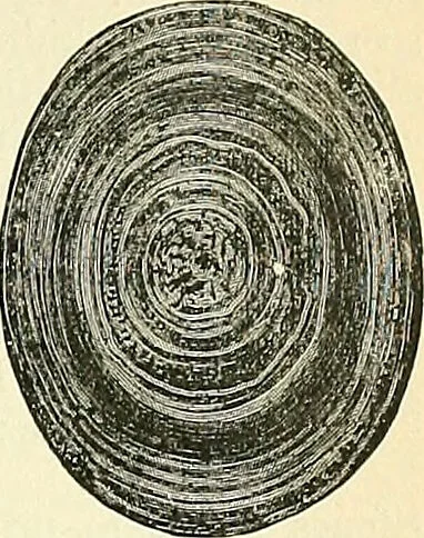 An illustration from An American text-book of genito-urinary diseases, syphilis and diseases of the skin / Ed. by L. Bolton Bangs ... and W. A. Hardaway ... Illustrated with 300 engravings and 20 full-page colored plates., 1898, leaf 427