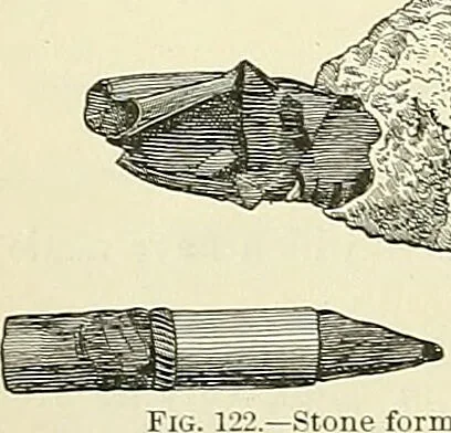 An illustration from An American text-book of genito-urinary diseases, syphilis and diseases of the skin / Ed. by L. Bolton Bangs ... and W. A. Hardaway ... Illustrated with 300 engravings and 20 full-page colored plates., 1898, leaf 430