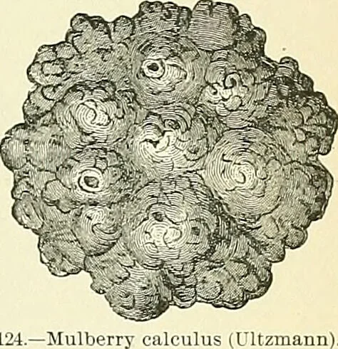 An illustration from An American text-book of genito-urinary diseases, syphilis and diseases of the skin / Ed. by L. Bolton Bangs ... and W. A. Hardaway ... Illustrated with 300 engravings and 20 full-page colored plates., 1898, leaf 431