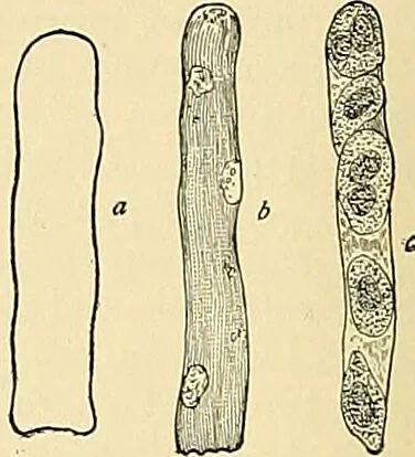 An illustration from An American text-book of genito-urinary diseases, syphilis and diseases of the skin / Ed. by L. Bolton Bangs ... and W. A. Hardaway ... Illustrated with 300 engravings and 20 full-page colored plates., 1898, leaf 46