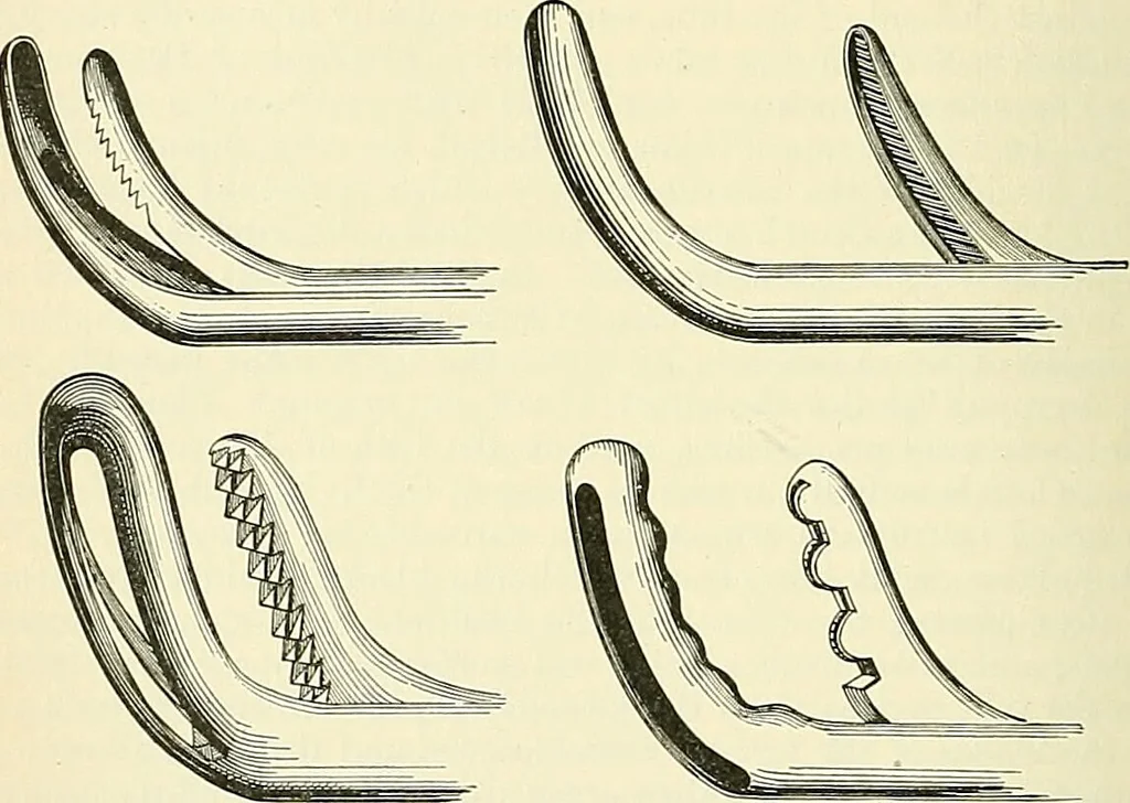 An illustration from An American text-book of genito-urinary diseases, syphilis and diseases of the skin / Ed. by L. Bolton Bangs ... and W. A. Hardaway ... Illustrated with 300 engravings and 20 full-page colored plates., 1898, leaf 464
