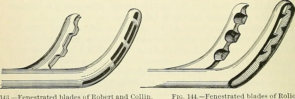 An illustration from An American text-book of genito-urinary diseases, syphilis and diseases of the skin / Ed. by L. Bolton Bangs ... and W. A. Hardaway ... Illustrated with 300 engravings and 20 full-page colored plates., 1898, leaf 464