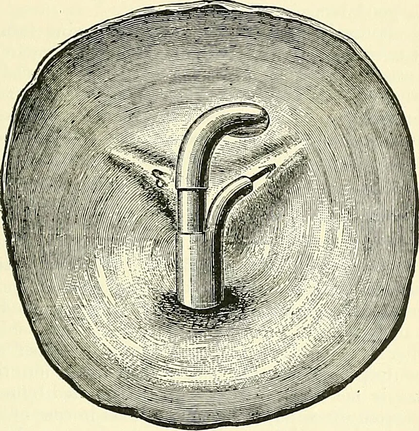 An illustration from An American text-book of genito-urinary diseases, syphilis and diseases of the skin / Ed. by L. Bolton Bangs ... and W. A. Hardaway ... Illustrated with 300 engravings and 20 full-page colored plates., 1898, leaf 505