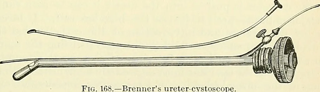 An illustration from An American text-book of genito-urinary diseases, syphilis and diseases of the skin / Ed. by L. Bolton Bangs ... and W. A. Hardaway ... Illustrated with 300 engravings and 20 full-page colored plates., 1898, leaf 505