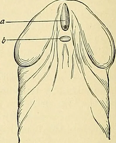 An illustration from An American text-book of genito-urinary diseases, syphilis and diseases of the skin / Ed. by L. Bolton Bangs ... and W. A. Hardaway ... Illustrated with 300 engravings and 20 full-page colored plates., 1898, leaf 56