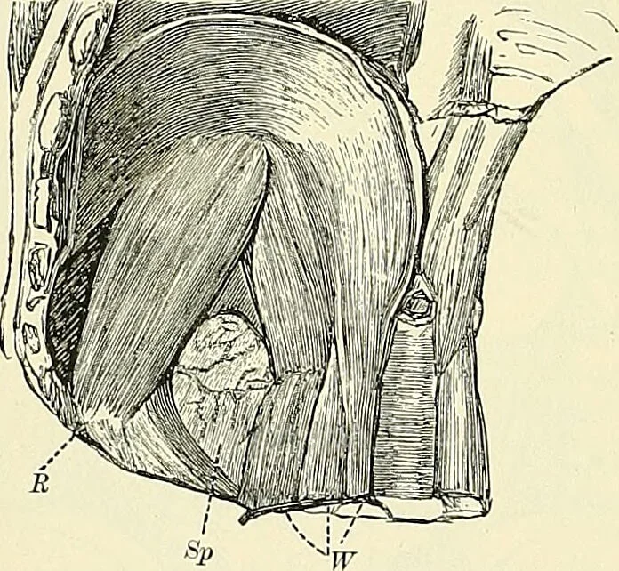 An illustration from An American text-book of genito-urinary diseases, syphilis and diseases of the skin / Ed. by L. Bolton Bangs ... and W. A. Hardaway ... Illustrated with 300 engravings and 20 full-page colored plates., 1898, leaf 562