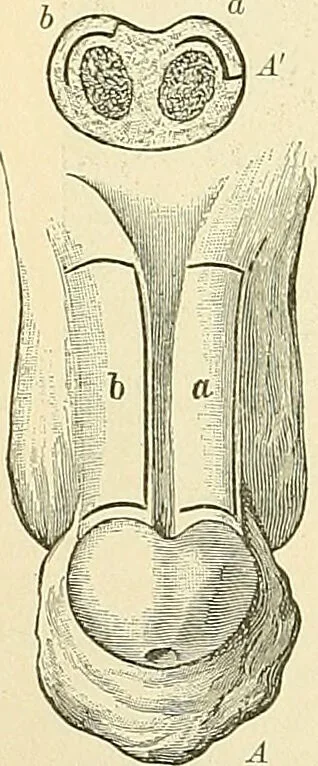 An illustration from An American text-book of genito-urinary diseases, syphilis and diseases of the skin / Ed. by L. Bolton Bangs ... and W. A. Hardaway ... Illustrated with 300 engravings and 20 full-page colored plates., 1898, leaf 58