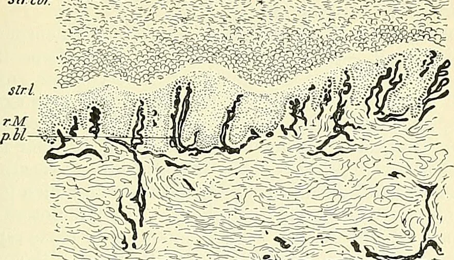 An illustration from An American text-book of genito-urinary diseases, syphilis and diseases of the skin / Ed. by L. Bolton Bangs ... and W. A. Hardaway ... Illustrated with 300 engravings and 20 full-page colored plates., 1898, leaf 803