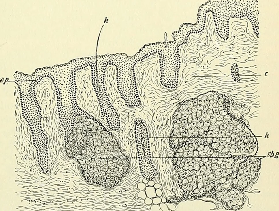 An illustration from An American text-book of genito-urinary diseases, syphilis and diseases of the skin / Ed. by L. Bolton Bangs ... and W. A. Hardaway ... Illustrated with 300 engravings and 20 full-page colored plates., 1898, leaf 805