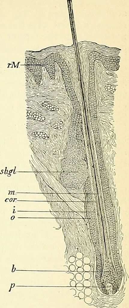 An illustration from An American text-book of genito-urinary diseases, syphilis and diseases of the skin / Ed. by L. Bolton Bangs ... and W. A. Hardaway ... Illustrated with 300 engravings and 20 full-page colored plates., 1898, leaf 807