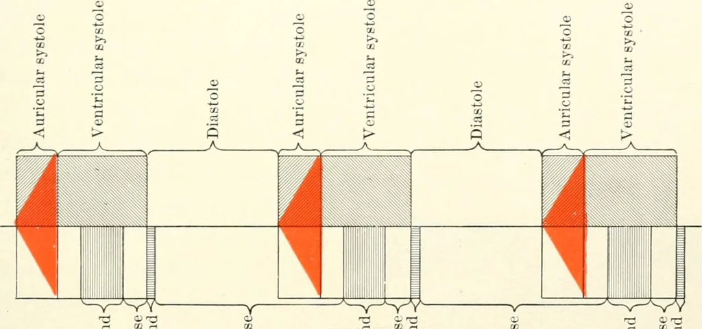 An illustration from Diseases of the heart and arterial system : designed to be a practical presentation of the subject for the use of students and practitioners of medicine / by Robert H. Babcock ... with three coloured plates and one hundred and thirty-nine illustrations., 1903, leaf 293