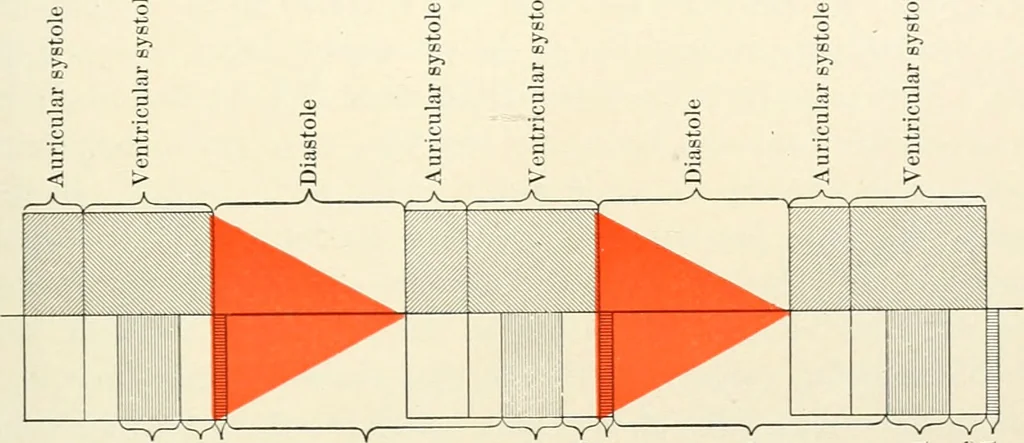 An illustration from Diseases of the heart and arterial system : designed to be a practical presentation of the subject for the use of students and practitioners of medicine / by Robert H. Babcock ... with three coloured plates and one hundred and thirty-nine illustrations., 1903, leaf 407