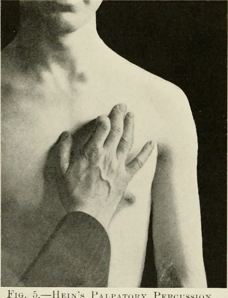 An illustration from Diseases of the heart and arterial system : designed to be a practical presentation of the subject for the use of students and practitioners of medicine / by Robert H. Babcock ... with three coloured plates and one hundred and thirty-nine illustrations., 1903, leaf 42