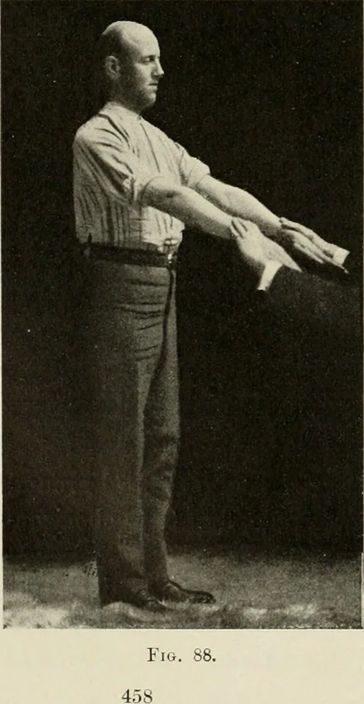 An illustration from Diseases of the heart and arterial system : designed to be a practical presentation of the subject for the use of students and practitioners of medicine / by Robert H. Babcock ... with three coloured plates and one hundred and thirty-nine illustrations., 1903, leaf 492