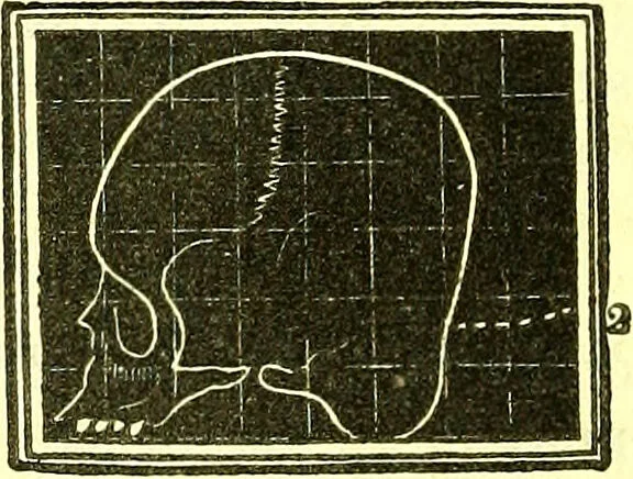 An illustration from Outlines of prenology., 1836, leaf 12