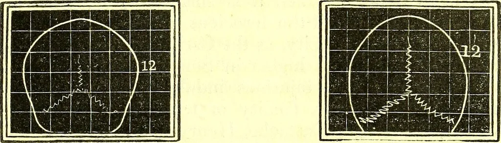 An illustration from Outlines of prenology., 1836, leaf 17